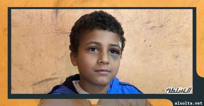 الطفل عبد الرحمن بعد ان القاه عامل من فوق سطح مدرسة بسوهاج
