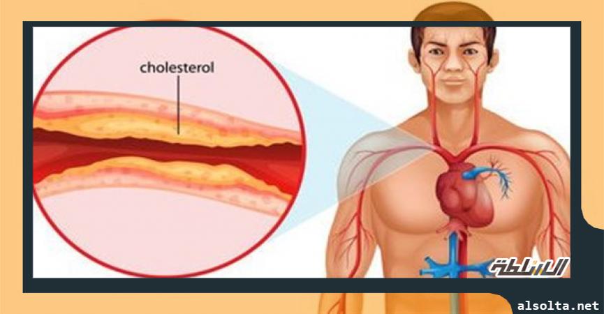 زيادة الكوليسترول في الدم