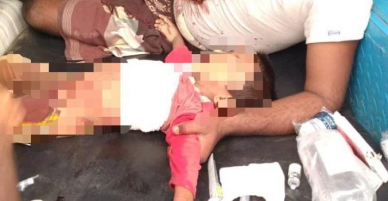 مليشيا الحوثي تقتل طفلا عمره 4 سنوات في حيس