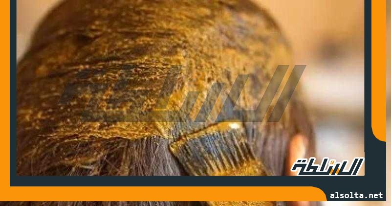 فوائد الحنة للشعر.. منها تقليل الهيشان وحمايته من أشعة الشمس