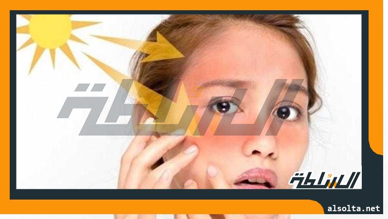 خبراء يقدمون نصائح من أجل البقاء آمنا من أشعة الشمس