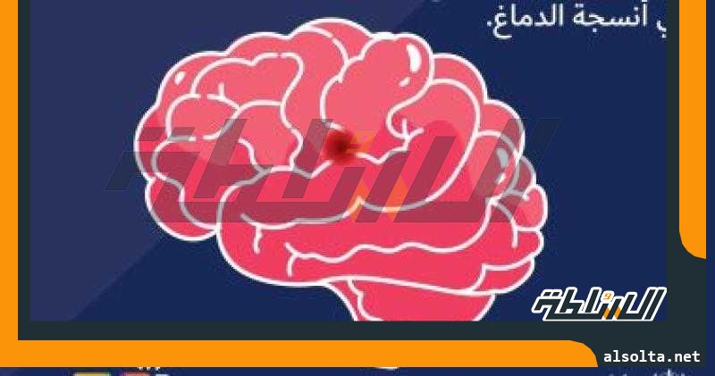 الصحة العالمية: سلوكيات خاطئة تزيد خطر الإصابة بالسكتة الدماغية