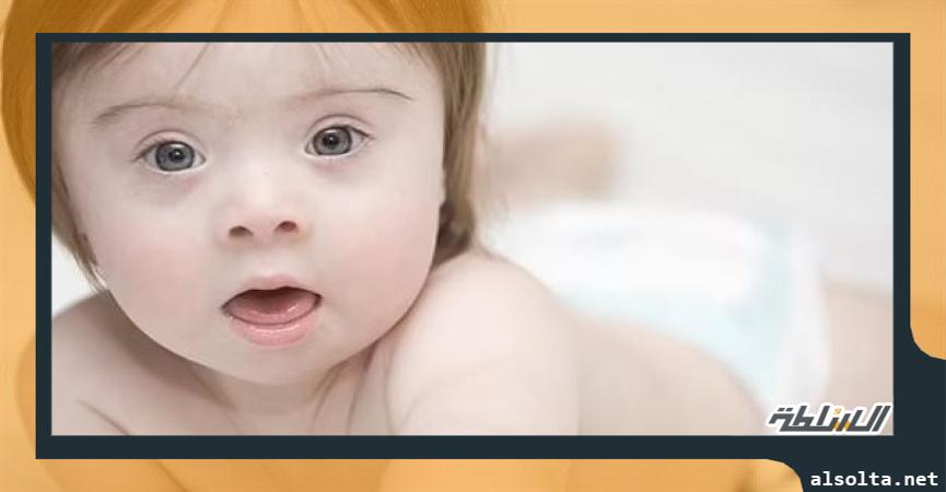 صحة وطب طفل متلازمة داون